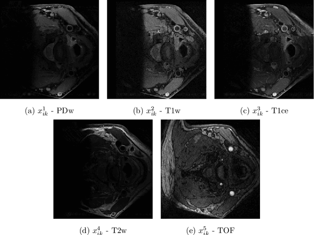 Figure 1 for Semi-supervised learning and integration of multi-sequence MR-images for carotid vessel wall and plaque segmentation