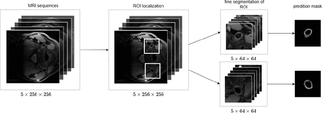 Figure 3 for Semi-supervised learning and integration of multi-sequence MR-images for carotid vessel wall and plaque segmentation
