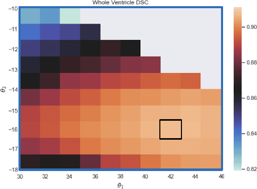 Figure 1 for Optimal operating MR contrast for brain ventricle parcellation