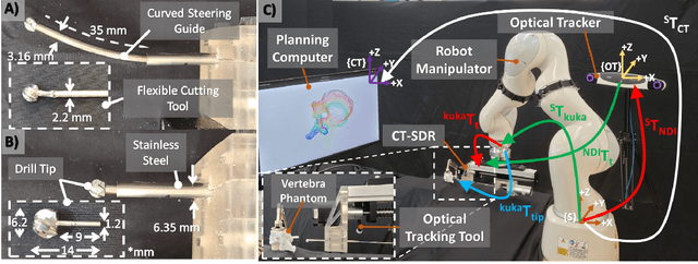 Figure 3 for A Patient-Specific Framework for Autonomous Spinal Fixation via a Steerable Drilling Robot