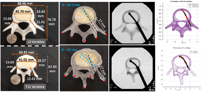 Figure 4 for A Patient-Specific Framework for Autonomous Spinal Fixation via a Steerable Drilling Robot