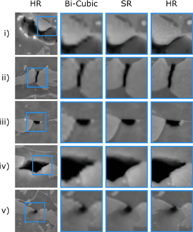 Figure 3 for Resolution Enhancement of Scanning Electron Micrographs using Artificial Intelligence