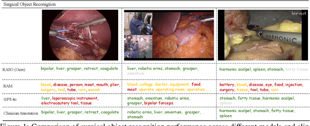 Figure 1 for Recognize Any Surgical Object: Unleashing the Power of Weakly-Supervised Data