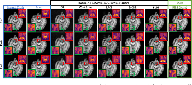 Figure 1 for Accelerating Longitudinal MRI using Prior Informed Latent Diffusion