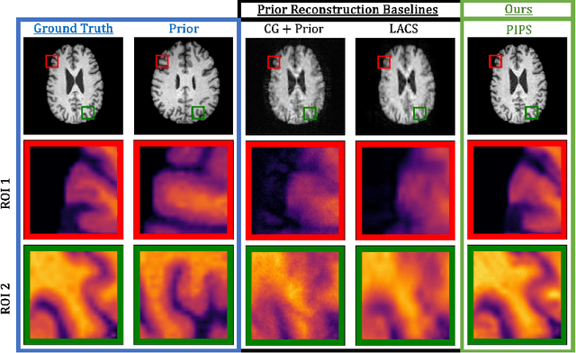 Figure 3 for Accelerating Longitudinal MRI using Prior Informed Latent Diffusion