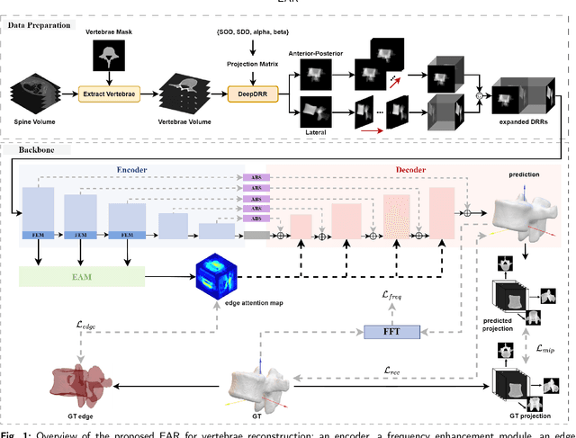 Figure 1 for EAR: Edge-Aware Reconstruction of 3-D vertebrae structures from bi-planar X-ray images