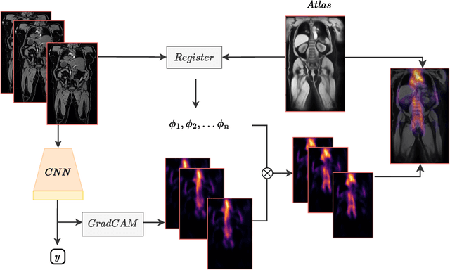 Figure 1 for Atlas-Based Interpretable Age Prediction