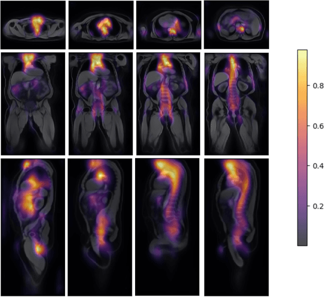 Figure 4 for Atlas-Based Interpretable Age Prediction