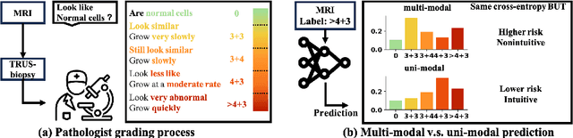 Figure 1 for Poisson Ordinal Network for Gleason Group Estimation Using Bi-Parametric MRI