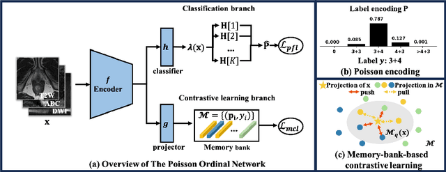 Figure 3 for Poisson Ordinal Network for Gleason Group Estimation Using Bi-Parametric MRI