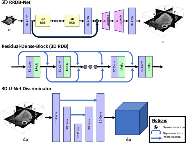 Figure 1 for 3D Volumetric Super-Resolution in Radiology Using 3D RRDB-GAN