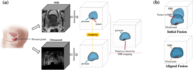 Figure 1 for Registration-Enhanced Segmentation Method for Prostate Cancer in Ultrasound Images