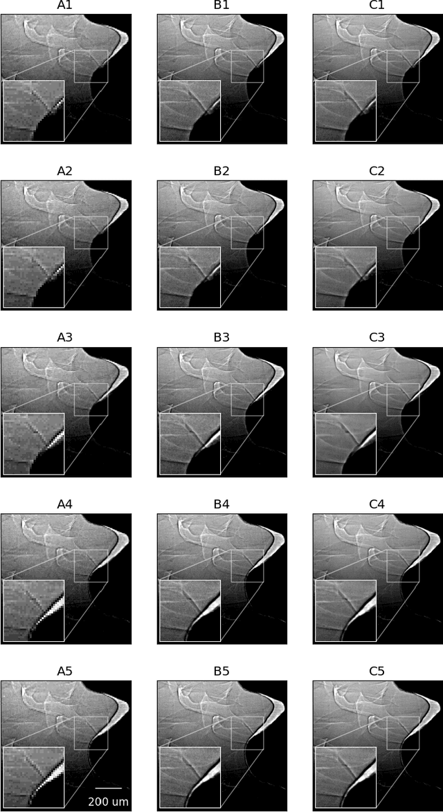 Figure 4 for Deep learning-based spatio-temporal fusion for high-fidelity ultra-high-speed x-ray radiography
