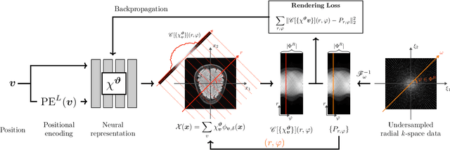 Figure 1 for NeRF Solves Undersampled MRI Reconstruction