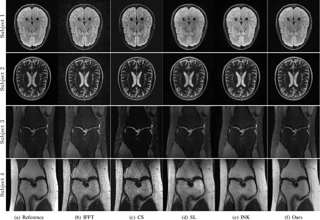 Figure 2 for NeRF Solves Undersampled MRI Reconstruction