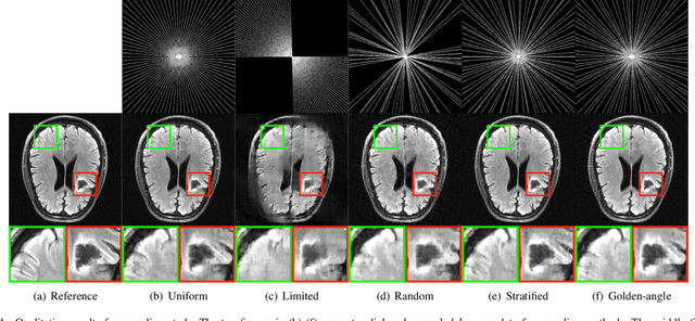 Figure 4 for NeRF Solves Undersampled MRI Reconstruction