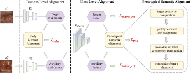 Figure 2 for Prototypical Cross-domain Knowledge Transfer for Cervical Dysplasia Visual Inspection