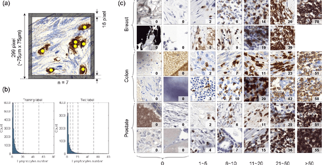 Figure 1 for LYSTO: The Lymphocyte Assessment Hackathon and Benchmark Dataset