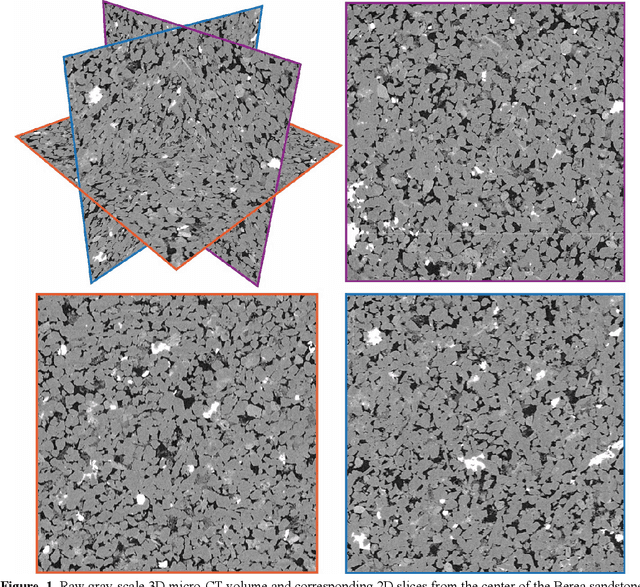 Figure 2 for Super-Resolution of 3D Micro-CT Images Using Generative Adversarial Networks: Enhancing Resolution and Segmentation Accuracy