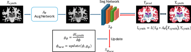 Figure 1 for Learn2Synth: Learning Optimal Data Synthesis Using Hypergradients