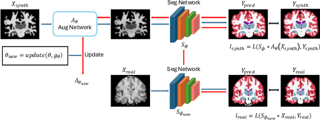 Figure 3 for Learn2Synth: Learning Optimal Data Synthesis Using Hypergradients