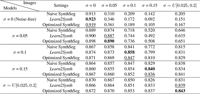 Figure 4 for Learn2Synth: Learning Optimal Data Synthesis Using Hypergradients