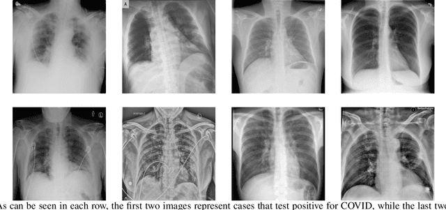 Figure 2 for Capturing Local and Global Features in Medical Images by Using Ensemble CNN-Transformer