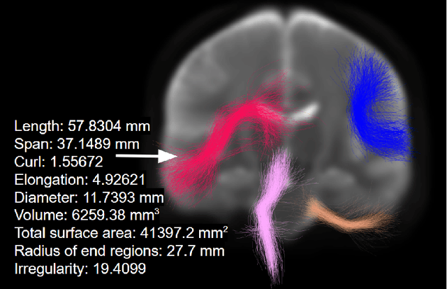 Figure 3 for The shape of the brain's connections is predictive of cognitive performance: an explainable machine learning study