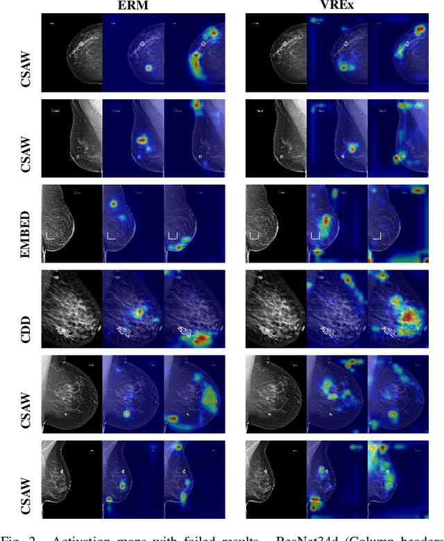 Figure 2 for Revisiting Invariant Learning for Out-of-Domain Generalization on Multi-Site Mammogram Datasets