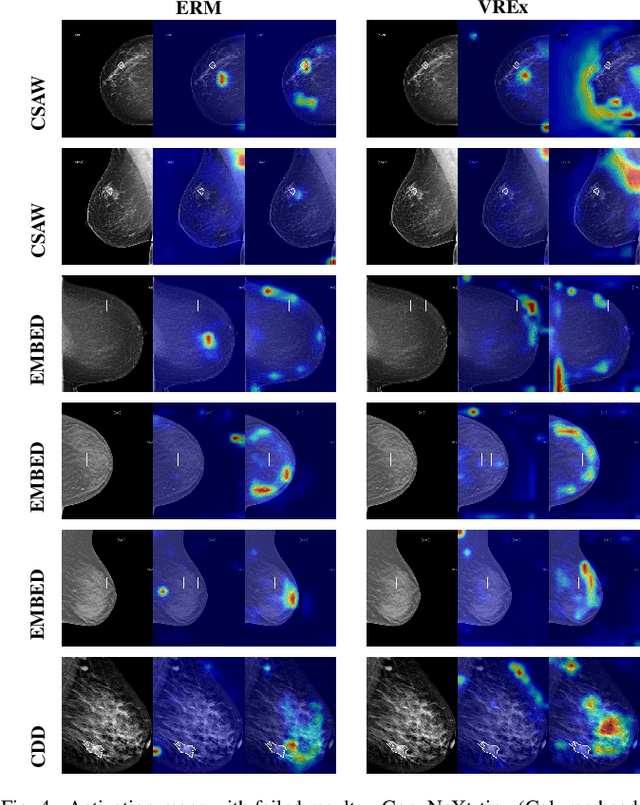 Figure 4 for Revisiting Invariant Learning for Out-of-Domain Generalization on Multi-Site Mammogram Datasets