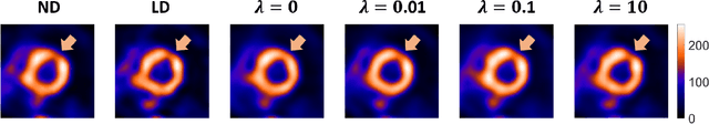 Figure 2 for DEMIST: A deep-learning-based task-specific denoising approach for myocardial perfusion SPECT