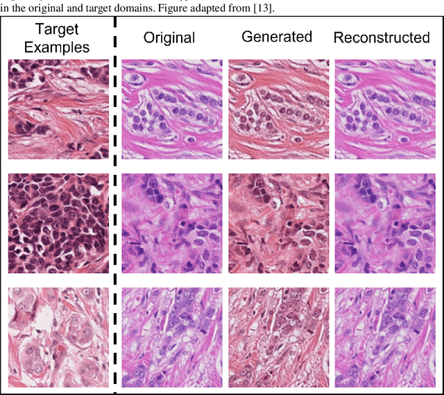 Figure 4 for Generative Adversarial Networks for Stain Normalisation in Histopathology