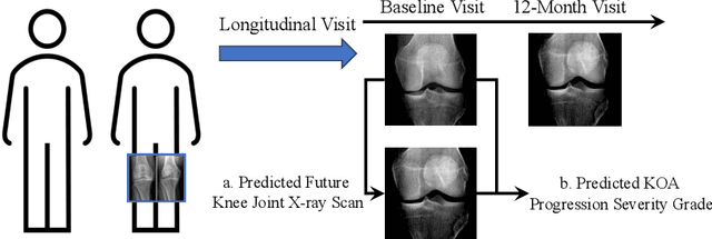 Figure 1 for Identity-Consistent Diffusion Network for Grading Knee Osteoarthritis Progression in Radiographic Imaging