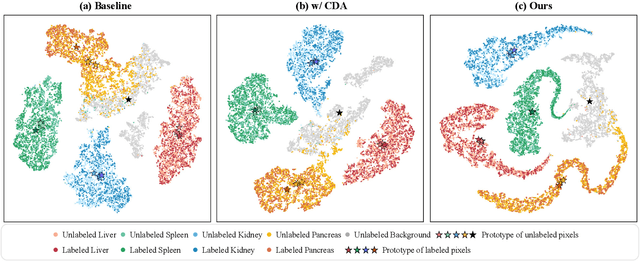 Figure 1 for Labeled-to-Unlabeled Distribution Alignment for Partially-Supervised Multi-Organ Medical Image Segmentation