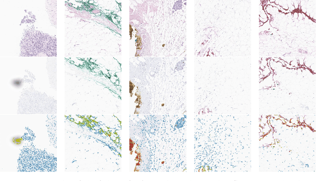 Figure 2 for Predicting Ki67, ER, PR, and HER2 Statuses from H&E-stained Breast Cancer Images
