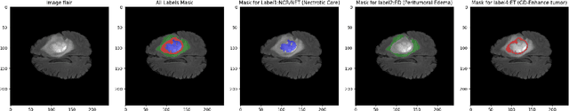 Figure 4 for LATUP-Net: A Lightweight 3D Attention U-Net with Parallel Convolutions for Brain Tumor Segmentation