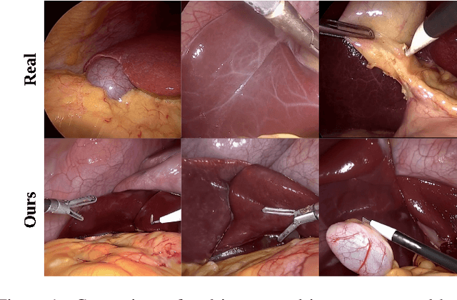 Figure 1 for SimuScope: Realistic Endoscopic Synthetic Dataset Generation through Surgical Simulation and Diffusion Models