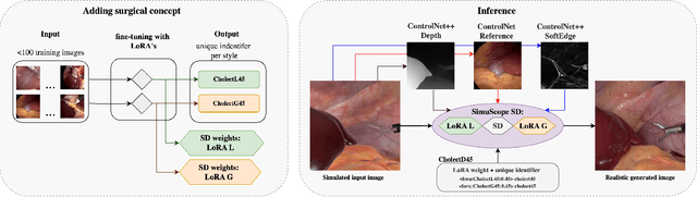 Figure 4 for SimuScope: Realistic Endoscopic Synthetic Dataset Generation through Surgical Simulation and Diffusion Models