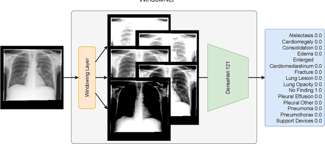 Figure 3 for WindowNet: Learnable Windows for Chest X-ray Classification