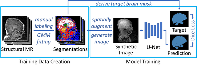 Figure 1 for Boosting Skull-Stripping Performance for Pediatric Brain Images