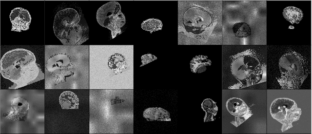 Figure 3 for Boosting Skull-Stripping Performance for Pediatric Brain Images