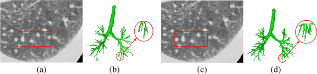 Figure 3 for Two-stage Contextual Transformer-based Convolutional Neural Network for Airway Extraction from CT Images