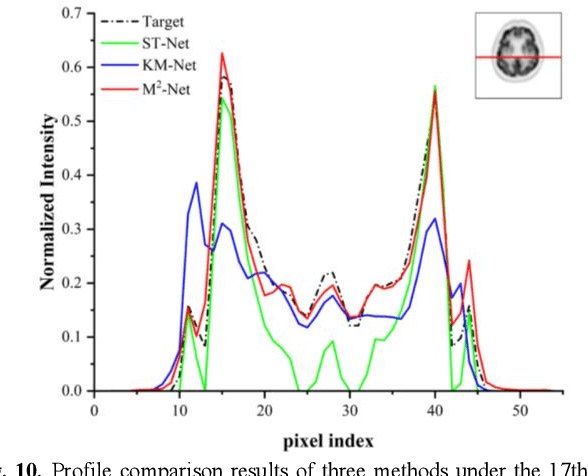 Figure 2 for Dynamic PET Image Prediction Using a Network Combining Reversible and Irreversible Modules