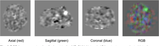 Figure 4 for Deep Labeling of fMRI Brain Networks