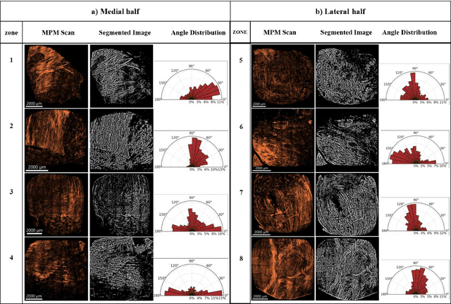 Figure 3 for Quantifying Smooth Muscles Regional Organization in the Rat Bladder Using Immunohistochemistry, Multiphoton Microscopy and Machine Learning