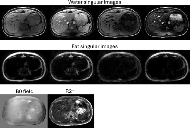 Figure 2 for Implicit neural representation for free-breathing MR fingerprinting (INR-MRF): co-registered 3D whole-liver water T1, water T2, proton density fat fraction, and R2* mapping