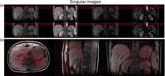 Figure 3 for Implicit neural representation for free-breathing MR fingerprinting (INR-MRF): co-registered 3D whole-liver water T1, water T2, proton density fat fraction, and R2* mapping