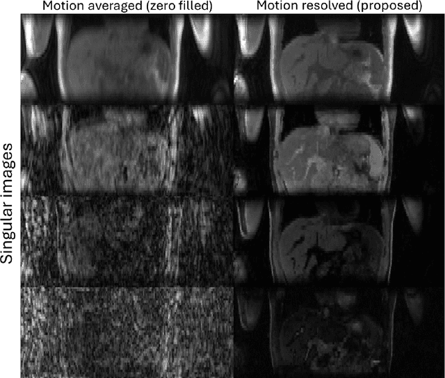 Figure 4 for Implicit neural representation for free-breathing MR fingerprinting (INR-MRF): co-registered 3D whole-liver water T1, water T2, proton density fat fraction, and R2* mapping