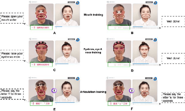 Figure 4 for HypomimiaCoach: An AU-based Digital Therapy System for Hypomimia Detection & Rehabilitation with Parkinson's Disease