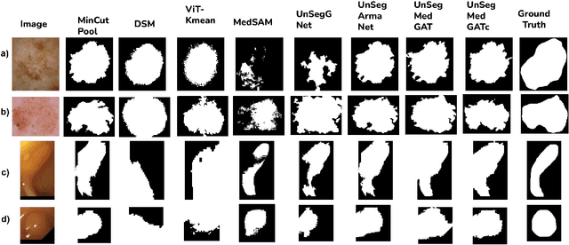 Figure 2 for UnSegMedGAT: Unsupervised Medical Image Segmentation using Graph Attention Networks Clustering